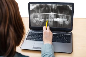 student analyzes X-ray picture of jaws on laptop screen
